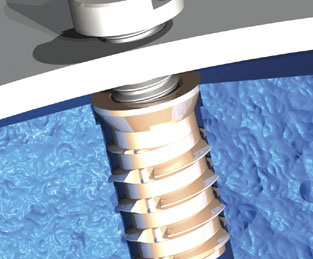 Tappex Foamsert, threaded inserts for structural foam, chipboard and fibre board